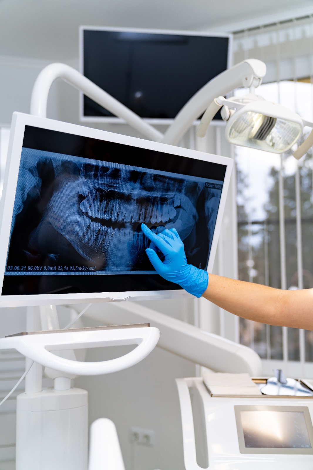 3d görüntüleme ve tomografi 3d görüntüleme ve tomografi