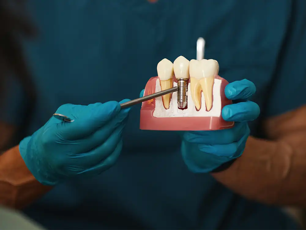 Ankara implant avantajları